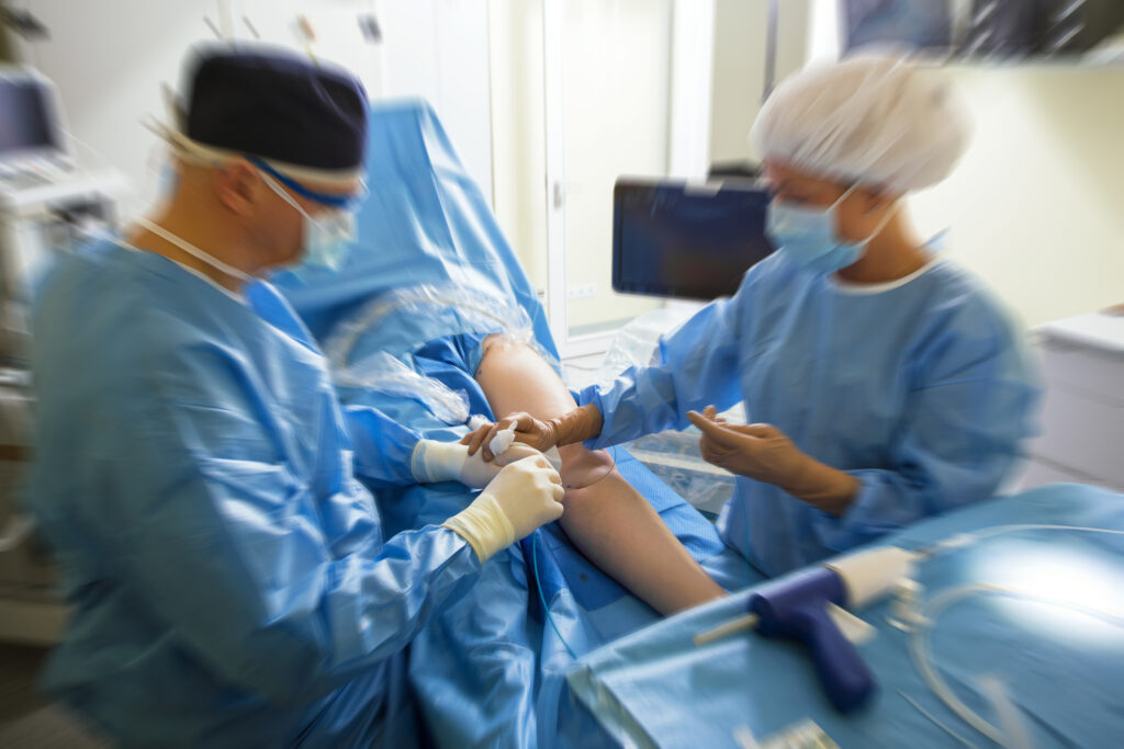 Endovenous Radiofrequency Ablation Los Angeles CA