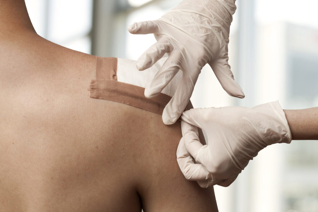 Chronic Wounds Los Angeles CA