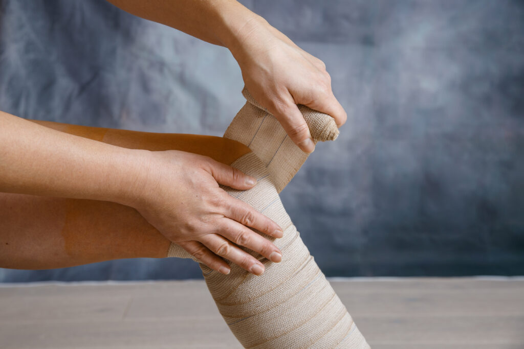 Compression Treatment Los Angeles CA