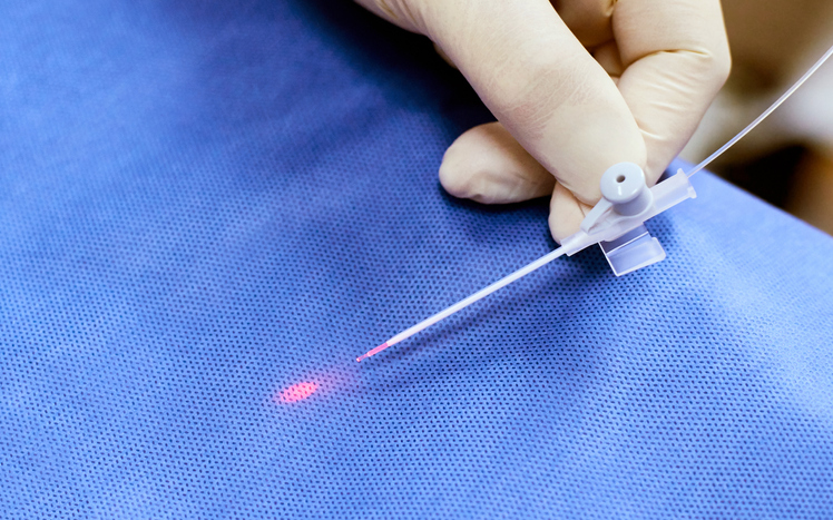 Endovenous Laser Therapy Los Angeles CA